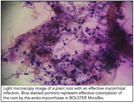 Sustane mycorrhizae under a microscope