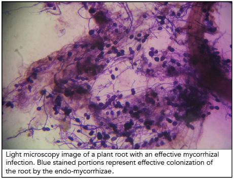 Sustane Mycorrhizae under a microscope